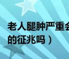 老人腿腫嚴(yán)重會(huì)導(dǎo)致什么結(jié)果（老人腿腫要死的征兆嗎）