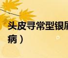 頭皮尋常型銀屑病嚴(yán)重嗎（什么是頭皮型銀屑?。?/>
                                    </a>
                                                </div>
                                    <div   id=