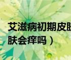 艾滋病初期皮膚癢會(huì)持續(xù)多久（艾滋病初期皮膚會(huì)癢嗎）