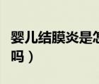 嬰兒結(jié)膜炎是怎么引起的（嬰兒結(jié)膜炎會(huì)自愈嗎）