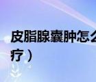 皮脂腺囊腫怎么治療最好（皮脂腺囊腫怎么治療）
