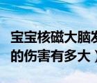 寶寶核磁大腦發(fā)育遲緩（腦部核磁共振對人體的傷害有多大）