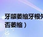 牙齦萎縮牙根外露怎么治療（怎樣判斷牙齦是否萎縮）
