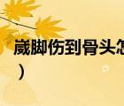 崴腳傷到骨頭怎么處理（崴腳傷到骨頭的表現(xiàn)）