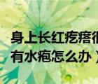 身上長(zhǎng)紅疙瘩很癢有水泡（身上長(zhǎng)紅疙瘩很癢有水皰怎么辦）