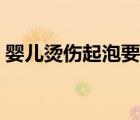 嬰兒燙傷起泡要弄破嗎（燙傷起泡要挑破嗎）