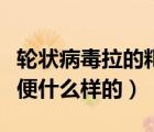 輪狀病毒拉的粑粑是什么樣子的（輪狀病毒大便什么樣的）
