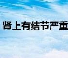 腎上有結(jié)節(jié)嚴重嗎男性（腎上有結(jié)節(jié)嚴重嗎）