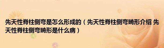 先天性脊柱側(cè)彎是怎么形成的（先天性脊柱側(cè)彎畸形介紹 先天性脊柱側(cè)彎畸形是什么?。? />
                                         </a>
                                    </div>
                                 <div   id=