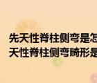 先天性脊柱側(cè)彎是怎么形成的（先天性脊柱側(cè)彎畸形介紹 先天性脊柱側(cè)彎畸形是什么病）