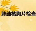 肺結(jié)核胸片檢查是什么（肺結(jié)核胸片的表現(xiàn)）
