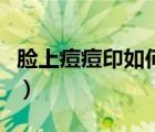 臉上痘痘印如何消除（臉上痘痕痘印怎么消除）