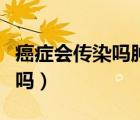 癌癥會傳染嗎腫瘤科醫(yī)生這樣說（癌癥會傳染嗎）