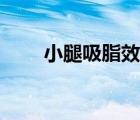 小腿吸脂效果（吸脂隆胸效果如何）