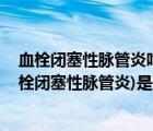 血栓閉塞性脈管炎吃什么藥效果好（脈管炎介紹 脈管炎(血栓閉塞性脈管炎)是什么?。?/>
                                    </a>
                                                </div>
                                    <div   id=