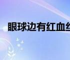 眼球邊有紅血絲（眼球有血絲是怎么回事）