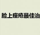 臉上痤瘡最佳治療方法（痤瘡桿菌治療方法）