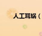 人工耳蝸（說一說人工耳蝸的簡介）