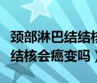 頸部淋巴結(jié)結(jié)核會(huì)癌變嗎嚴(yán)重嗎（頸部淋巴結(jié)結(jié)核會(huì)癌變嗎）