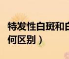 特發(fā)性白斑和白癜風的區(qū)別（白斑和白癜風有何區(qū)別）