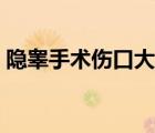 隱睪手術傷口大嗎（隱睪手術后傷口恢復期）