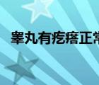 睪丸有疙瘩正常嗎（睪丸有疙瘩怎么回事）