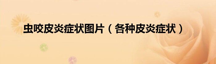 蟲咬皮炎癥狀圖片（各種皮炎癥狀）