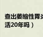 查出萎縮性胃炎醫(yī)生卻說沒事（萎縮性胃炎能活20年嗎）