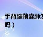 手背腱鞘囊腫怎么治療（腱鞘囊腫不治療可以嗎）