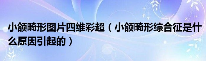 小頜畸形圖片四維彩超（小頜畸形綜合征是什么原因引起的）