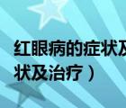 紅眼病的癥狀及治療用什么藥物（紅眼病的癥狀及治療）