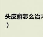 頭皮癬怎么治才能除根（支氣管哮喘能除根嗎）