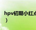 hpv初期小紅點照片（得了艾滋病有什么癥狀）