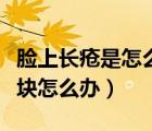 臉上長(zhǎng)瘡是怎么回事硬硬的很大（臉上長(zhǎng)瘡硬塊怎么辦）