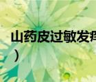 山藥皮過敏發(fā)癢怎么辦（對(duì)山藥皮過敏怎么辦）
