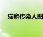 貓癬傳染人圖片（貓癬一定會傳染人嗎）