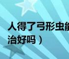 人得了弓形蟲能治好嗎女性（人得了弓形蟲能治好嗎）