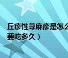 丘疹性蕁麻疹是怎么引起的及治療方法（息斯敏治療蕁麻疹要吃多久）