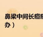 鼻梁中間長(zhǎng)痘痘是什么原因（鼻梁長(zhǎng)痘痘怎么辦）