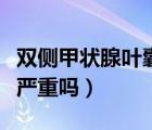 雙側(cè)甲狀腺葉囊性結(jié)節(jié)（甲狀腺雙葉囊性結(jié)節(jié)嚴(yán)重嗎）