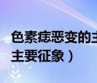 色素痣惡變的主要征象有哪些（色素痣惡變的主要征象）