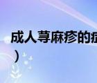 成人蕁麻疹的癥狀有哪些（成人蕁麻疹的癥狀）