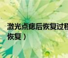 激光點痣后恢復過程圖點痣留疤了怎么辦（激光點痣后多久恢復）