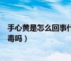 手心黃是怎么回事什么原因引起的女性（蕁麻疹手心癢是排毒嗎）