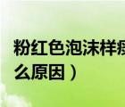 粉紅色泡沫樣痰是什么?。ǚ奂t色泡沫樣痰什么原因）