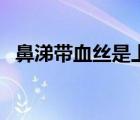 鼻涕帶血絲是上火了嗎（鼻涕有血怎么辦）