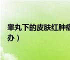 睪丸下的皮膚紅腫瘙癢用什么藥效果好（睪丸皮膚紅癢怎么辦）