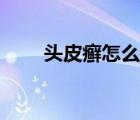 頭皮癬怎么治斷根（頭皮癬怎么治）