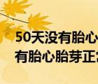 50天沒有胎心胎芽還有希望嗎（懷孕50天沒有胎心胎芽正常嗎）