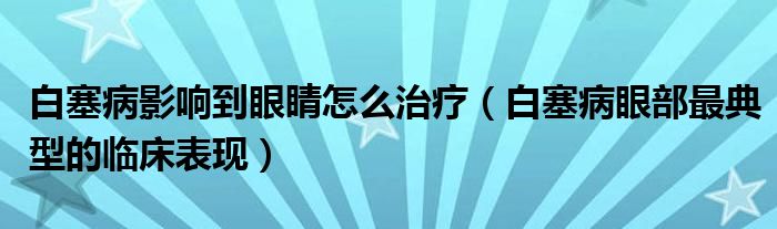 白塞病影響到眼睛怎么治療（白塞病眼部最典型的臨床表現(xiàn)）